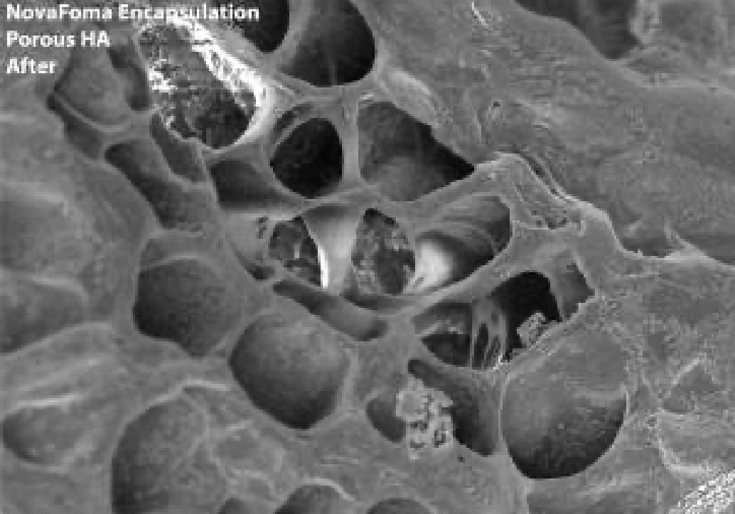 NovaFoma Encapsulation Porous HA