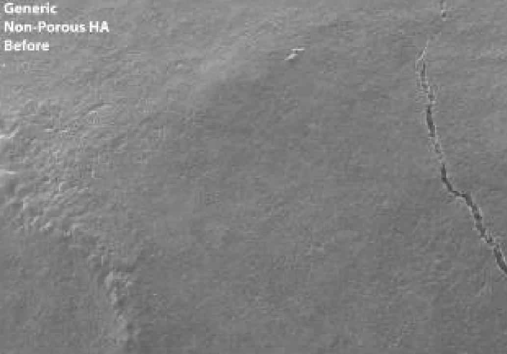 Generic Non-Porous HA